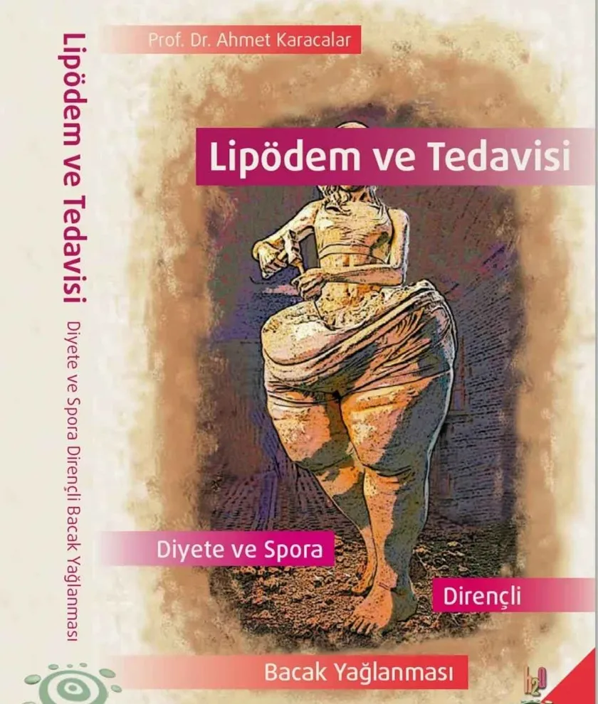 KİLO VEREMİYORSANIZ SUÇLU İRADENİZ DEĞİL, LİPÖDEM OLABİLİR